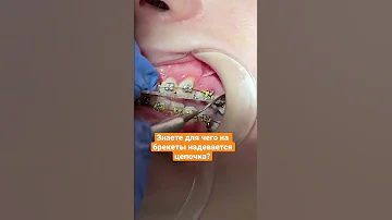 Эластическая цепочка