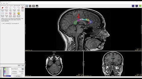 Analyze 15.0 - Segment: Divide Regions into Grid Sections
