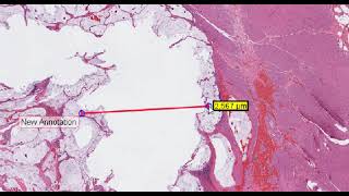 Aurora Mscope Clinical Demo