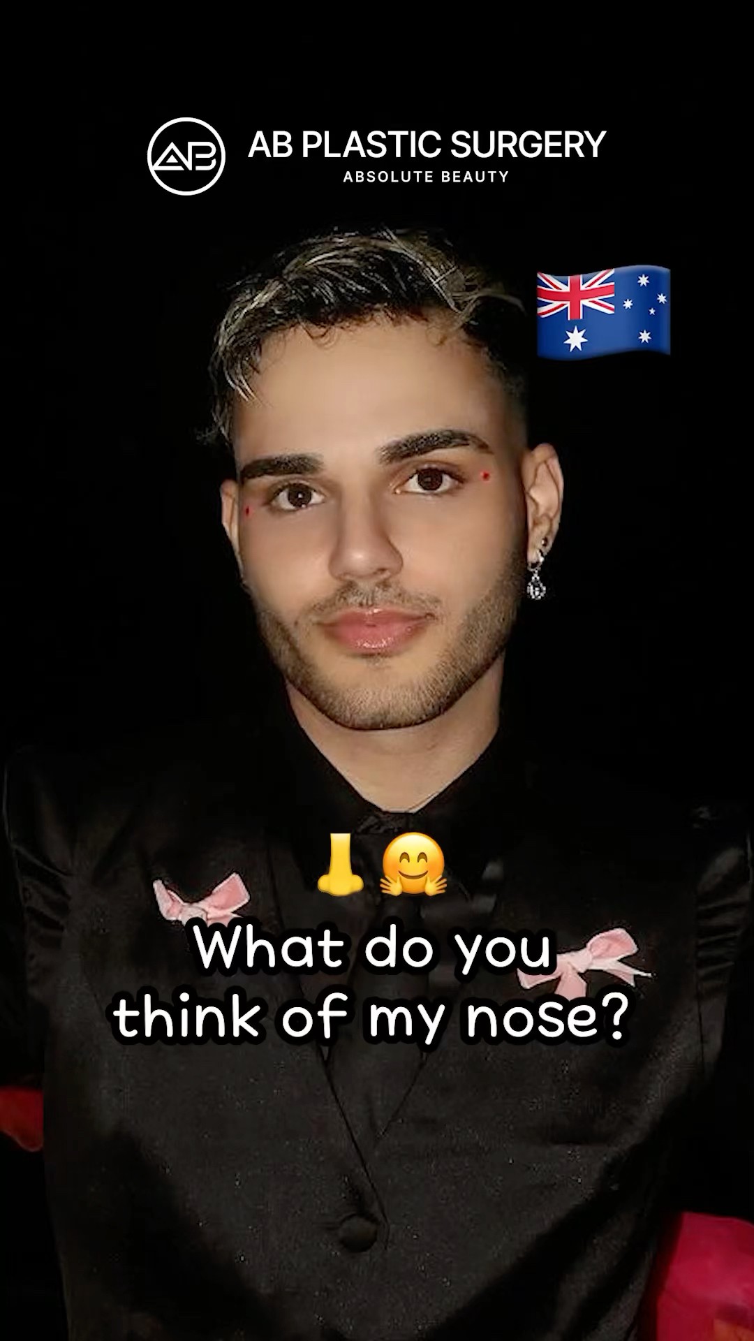 30 Seconds Male Nose Job Transformation | Before & After #koreanplasticsurgery
