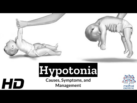 Video: Muscle hypotonia - what is it manifested? Reasons and methods of rehabilitation