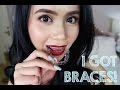 Invisalign Update#1: I GOT BRACES! | Anna Cay ♥