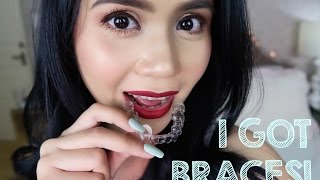 Invisalign Update#1: I GOT BRACES! | Anna Cay ♥ screenshot 5