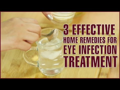 3 Easy & Effective Home Remedies For EYE INFECTION TREATMENT