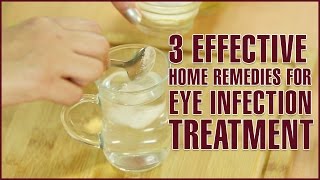 3 Easy & Effective Home Remedies For EYE INFECTION TREATMENT