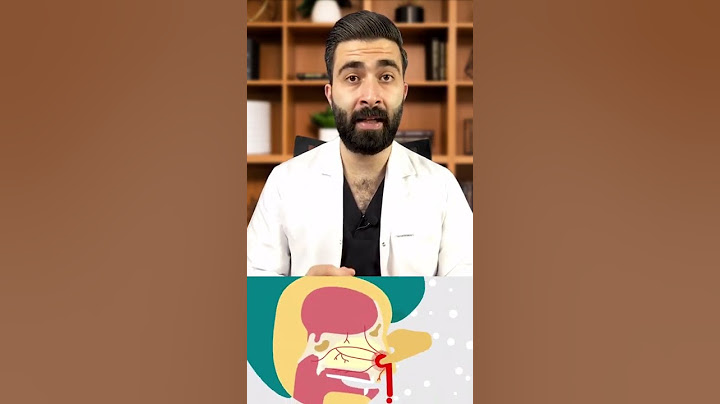 الطريقة الصحيحة لإيقاف نزيف الأنف ✅