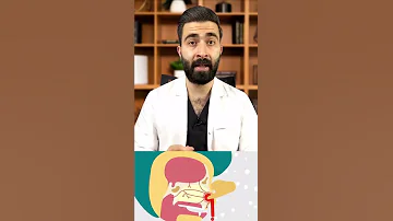 الطريقة الصحيحة لإيقاف نزيف الأنف 