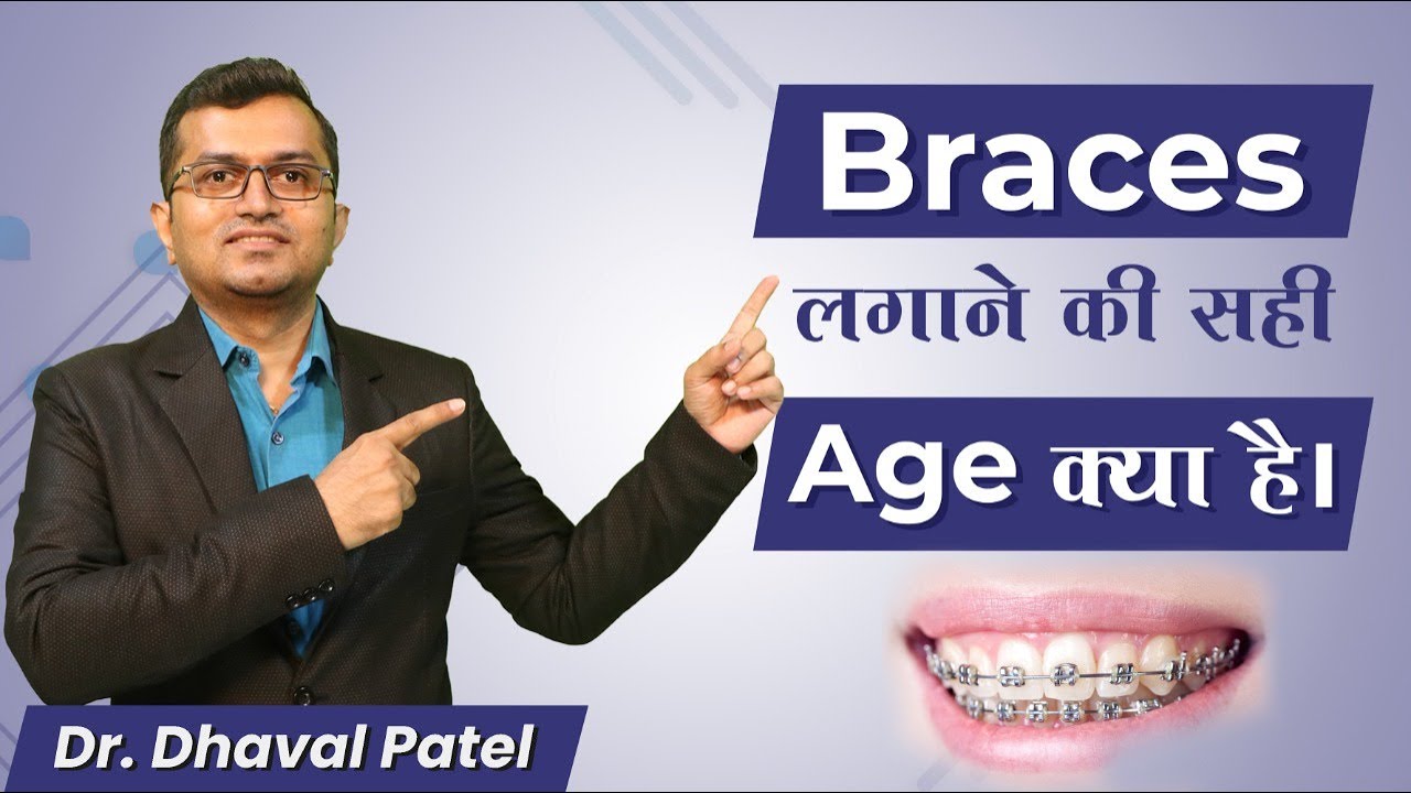 Braces लगाने की सही Age क्या है ? by_Dr. Dhaval Patel YouTube