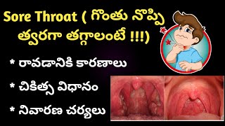 Sore Throat in Telugu (గొంతు నొప్పి )