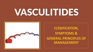 Vasculitides -  Classification, Clinical Features and Management Principles