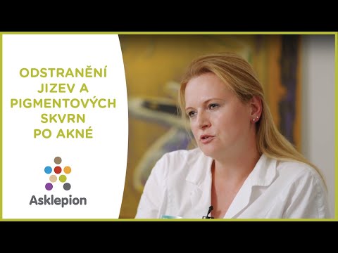 Video: Kyselina Glykolová Na Kůži Na Akné, Jizvy, Hyperpigmentace