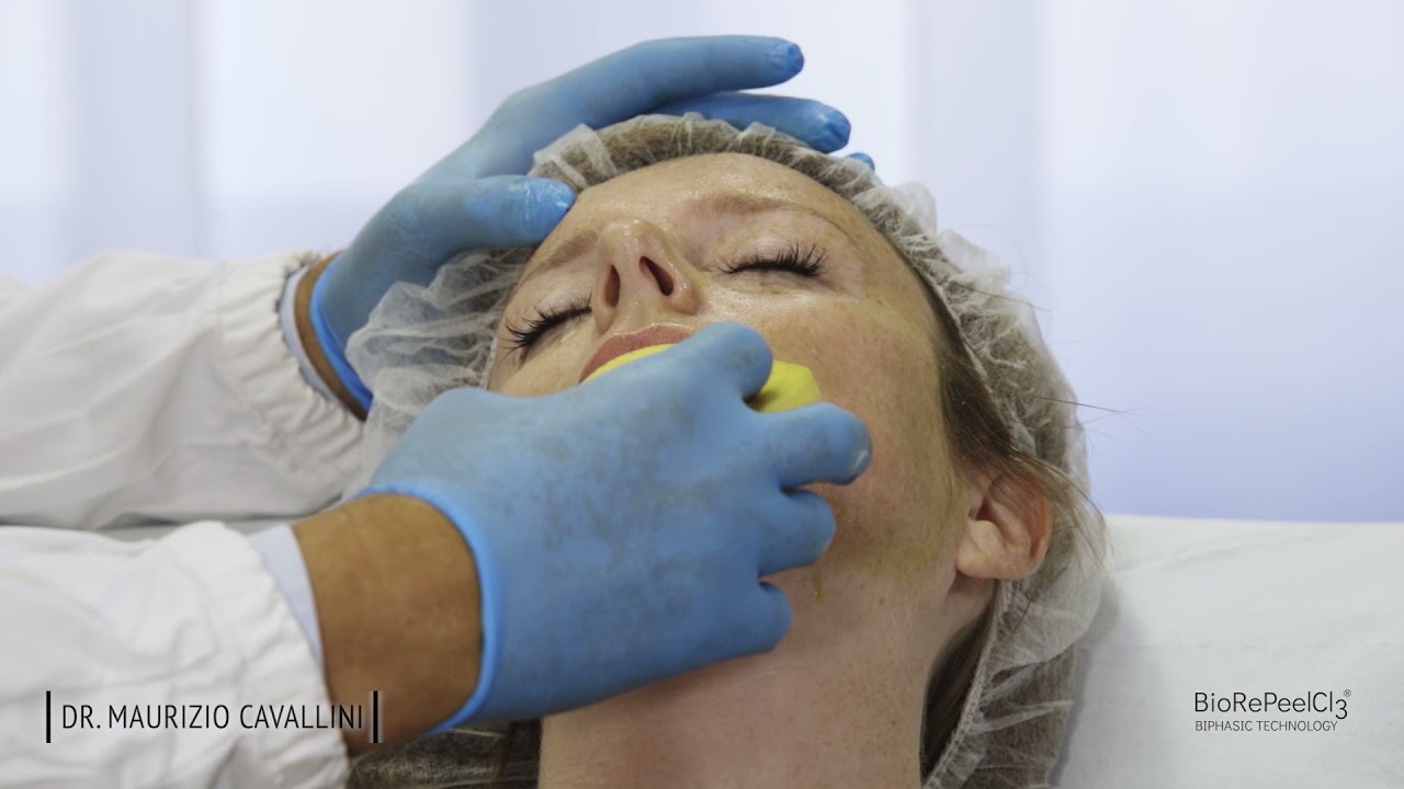 BioRePeel Treatment Protocol (Face)