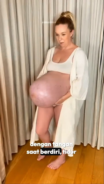 Ibu Mengandung dan Melahirkan Bayi Kembar #bayi #bayilucu #shortvideo
