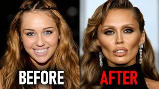 These Celebs Are Getting MORE BOTCHED Every Day…Before & After Photos