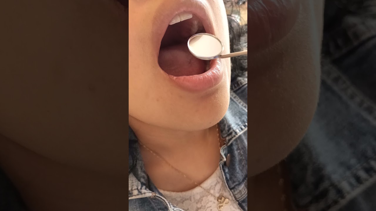 Exploración de la cavidad oral