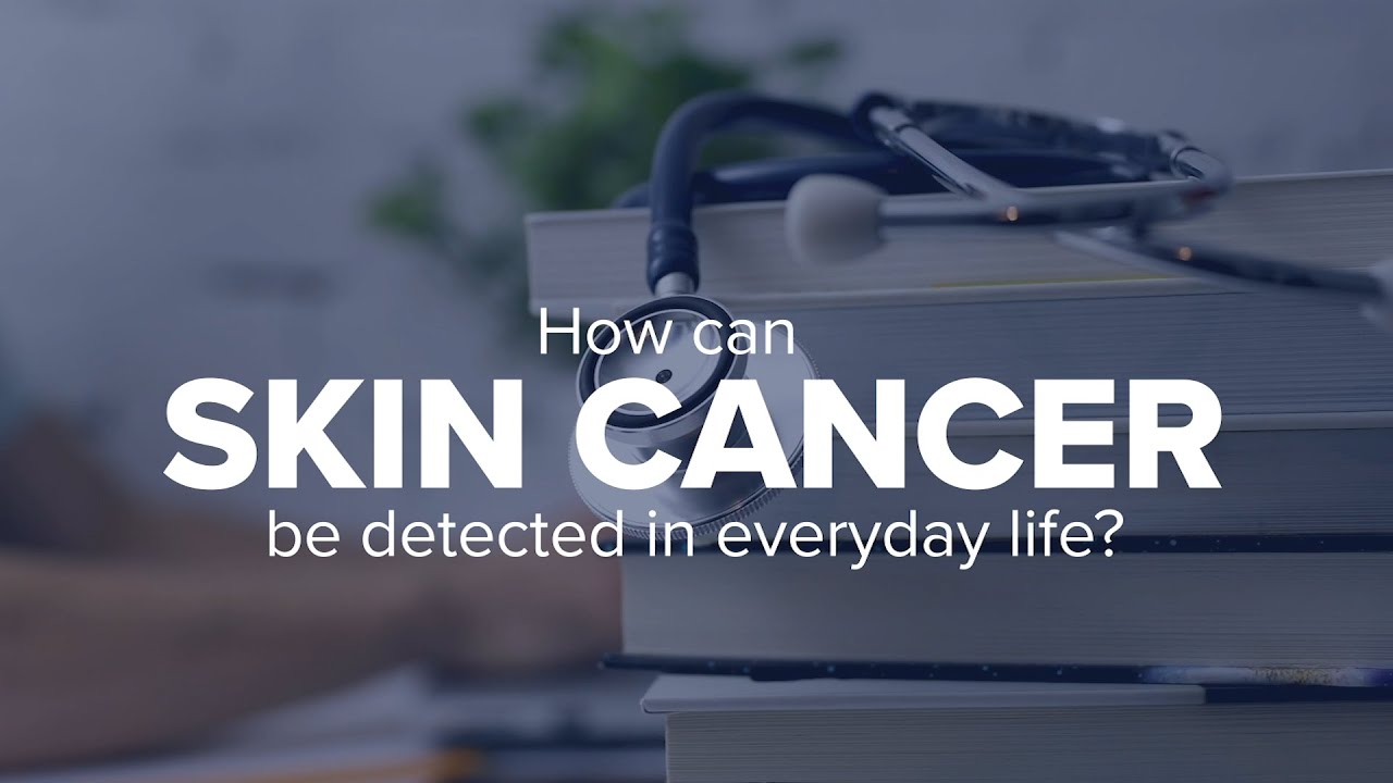 Expert Insights How can skin cancer be detected in everyday life