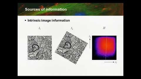 Basics of Image Processing: Image Registration