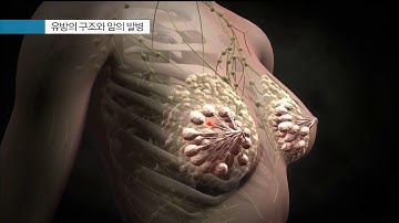 유방암 - 유방의 구조와 암의 발병