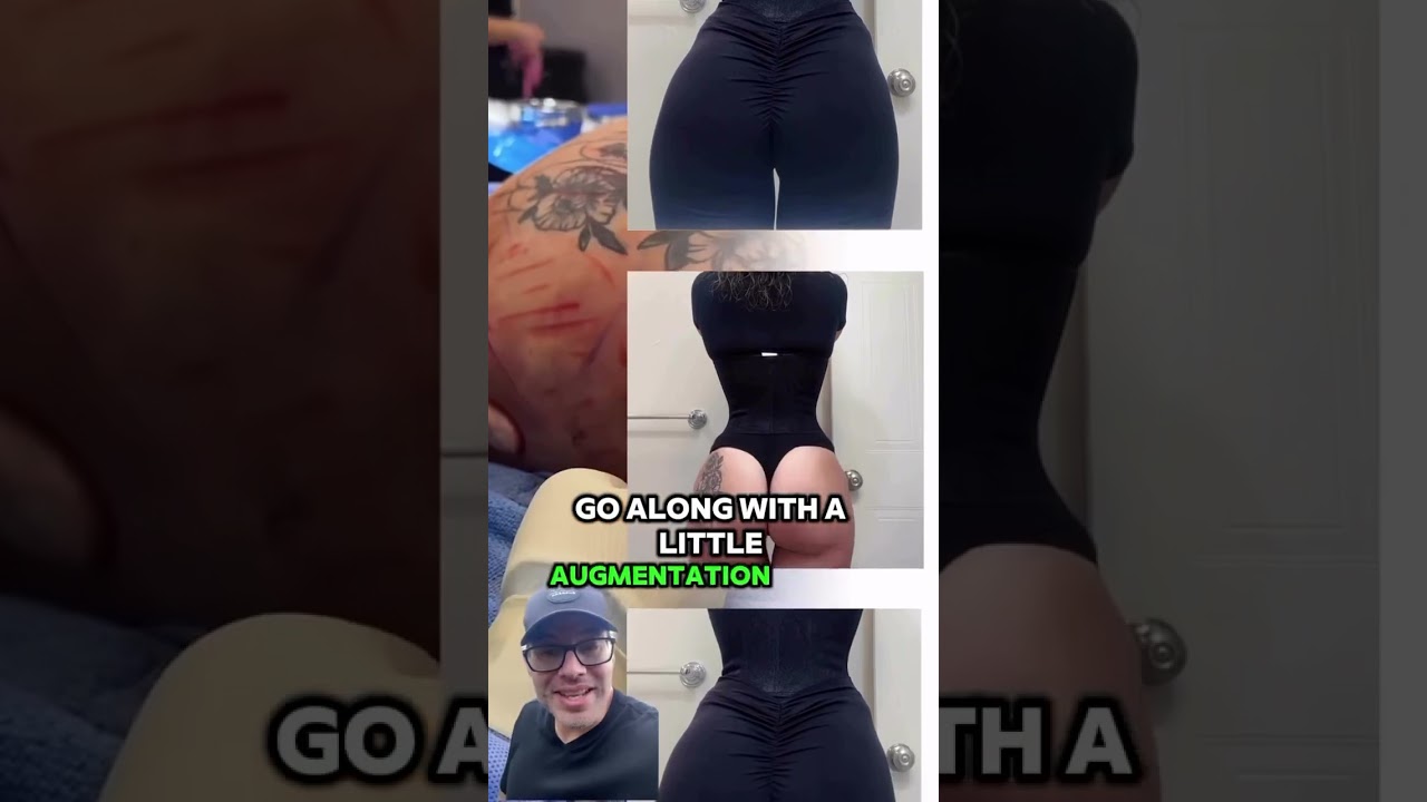 Transform Your Body with Alloclae & Rib X: The Ultimate Body Contouring Combo for a Snatched Waist!