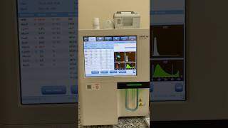 CBC test kaise kar te hai complete blood count Haemoglobin #shortvideo #cutebaby #tranding #viral￼