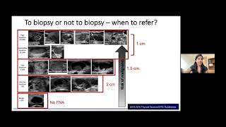 Newton-Wellesley Medical Group Lunch & Learn: Thyroid nodule clinic