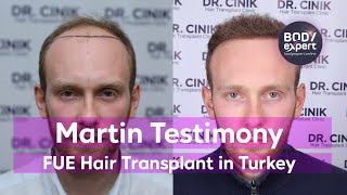Affordable Hair Transplant In Turkey At Dr Cinik S Clinic Www Emrahcinik Com Prlog
