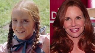 Aging Gracefully - Should Plastic Surgery Be Part of The Plan
