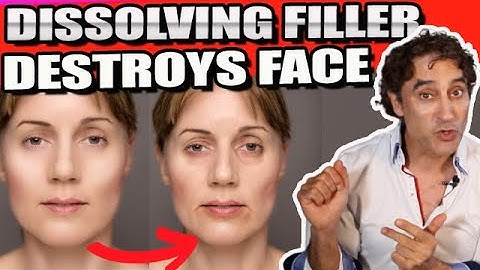 NEVER DISSOLVE YOUR FILLER || Hyaluronidase