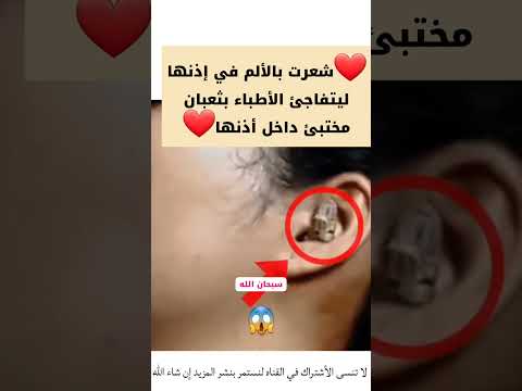 شاهد ماذا وجد الأطباء في إذنها القرآن الكريم  راحة نفسية 