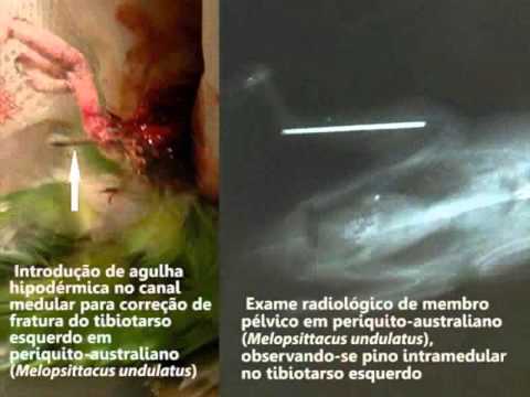 Vídeo: O que significa tibiotarso?