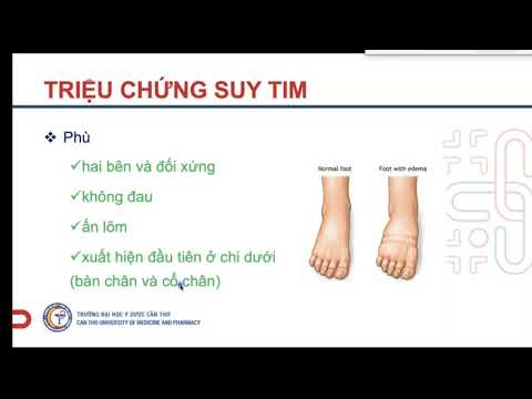 Video CHẨN ĐOÁN VÀ ĐIỀU TRỊ SUY TIM MẠN - NỘI BỆNH LÝ 1 - youtube