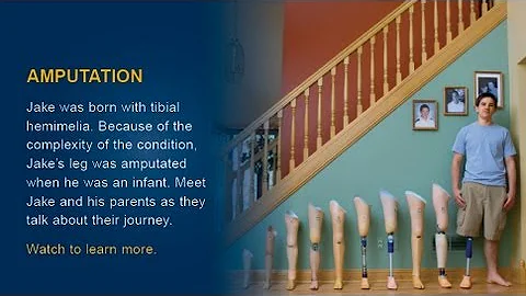 Jake's Story: The Michigan Difference at Mott Chil...
