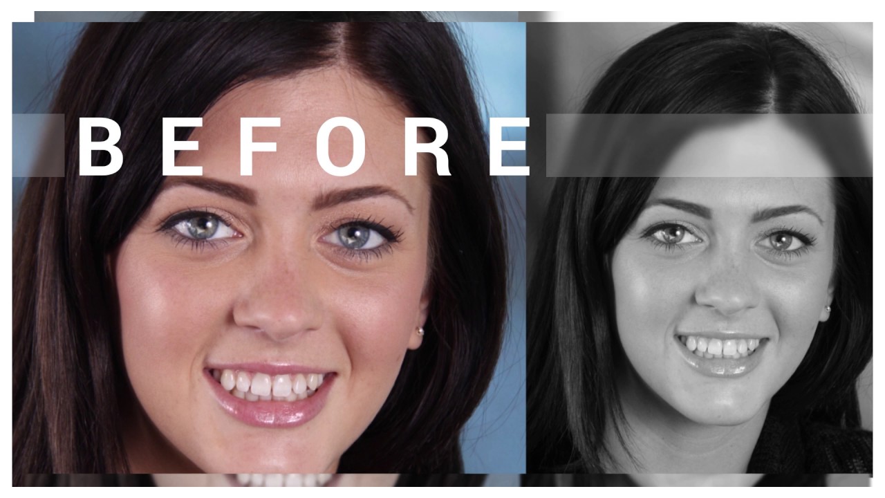 The Best Cosmetic Dentist in Long Beach