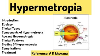 Hypermetropia|AK Khurana 6th Edition|#optometry #ophthalmologist #youtube #trending #hypermetropia