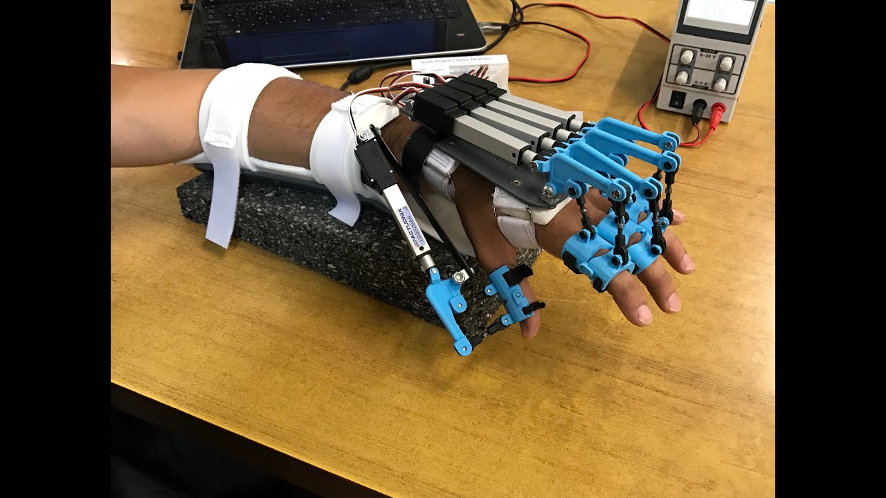Exoesqueleto de mano, para la rehabilitación de personas con accidentes