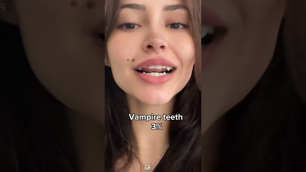 Types of teeth and their rarity you may have 👀!! #subscribe #aesthetic #100kvews #fypシ゚viral
