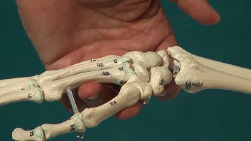 scaphoid manipulation dorsal lesion