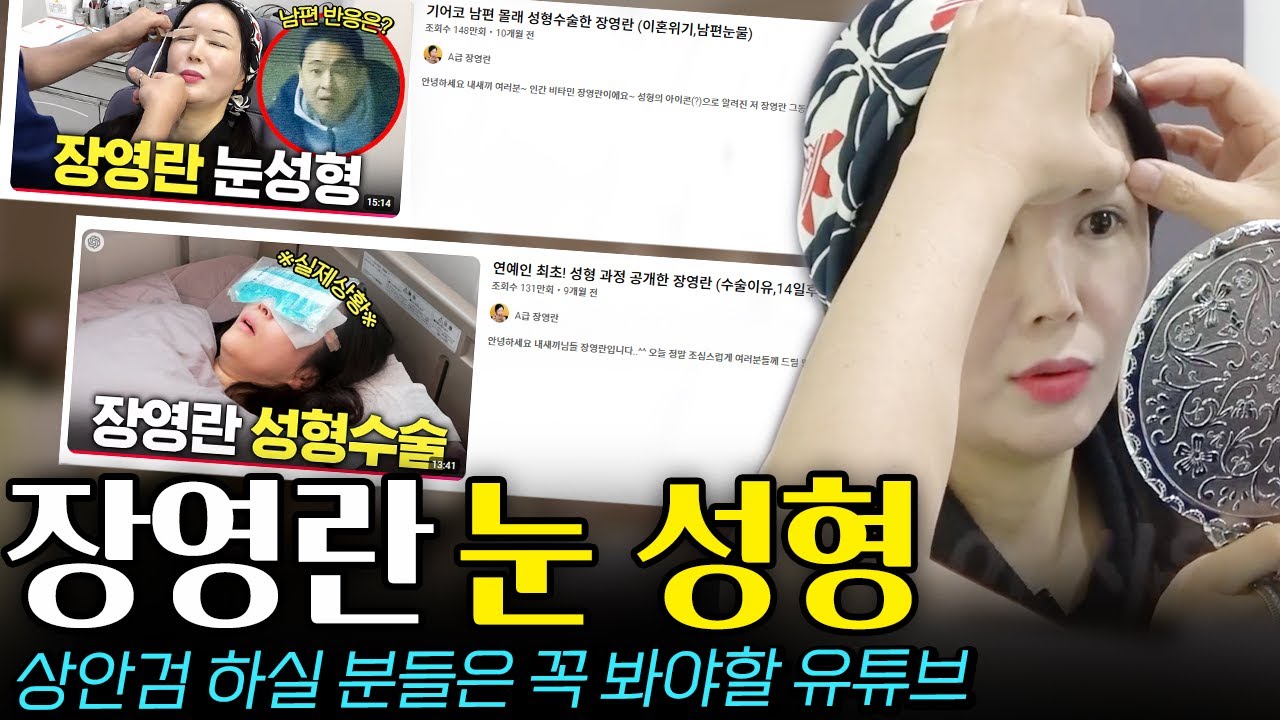 [Thẩm mỹ viện Jayjun, Da liễu] Hãy đọc bài này trước khi phẫu thuật cắt mí mắt trên. Những điều bạn cần biết trước khi cân nhắc phẫu thuật.