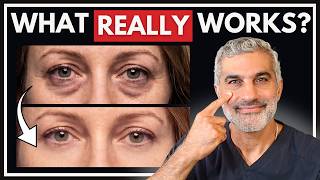 How to Treat Under-Eye Aging From A Facial Plastic Surgeon: Eye Bags, Dark Circles, Undereye Hollows screenshot 4