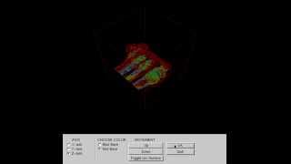 Visualization of Medical Data