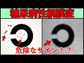 【失明の恐れ】糖尿病性網膜症のサインについて解説