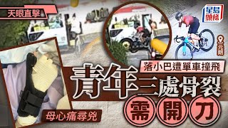 Download Lagu 元朗男落小巴遭單車撞裂骨 騎手惡人先告狀再逃逸 母心痛尋兇|天眼直擊|星島頭條新聞|不顧而去|元朗|下村園|上水|小巴|單車|紅Van|車禍|尋人 MP3 Download Lagu 元朗男落小巴遭單車撞裂骨 騎手惡人先告狀再逃逸 母心痛尋兇|天眼直擊|星島頭條新聞|不顧而去|元朗|下村園|上水|小巴|單車|紅Van|車禍|尋人 MP3