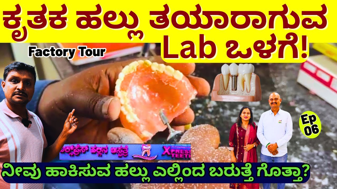 DENTAL FACTORY-“ಲ್ಯಾಬ್ ಒಳಗೆ ಕೃತಕ ಹಲ್ಲು ಹೇಗೆ ತಯಾರಾಗುತ್ತೆ ನೋಡಿ!!-E06-KDC Dental-Niranjan Param Shetty