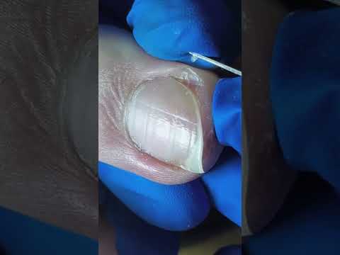 Cute nails satisfying pedicure #nails#satisfying#pedicure