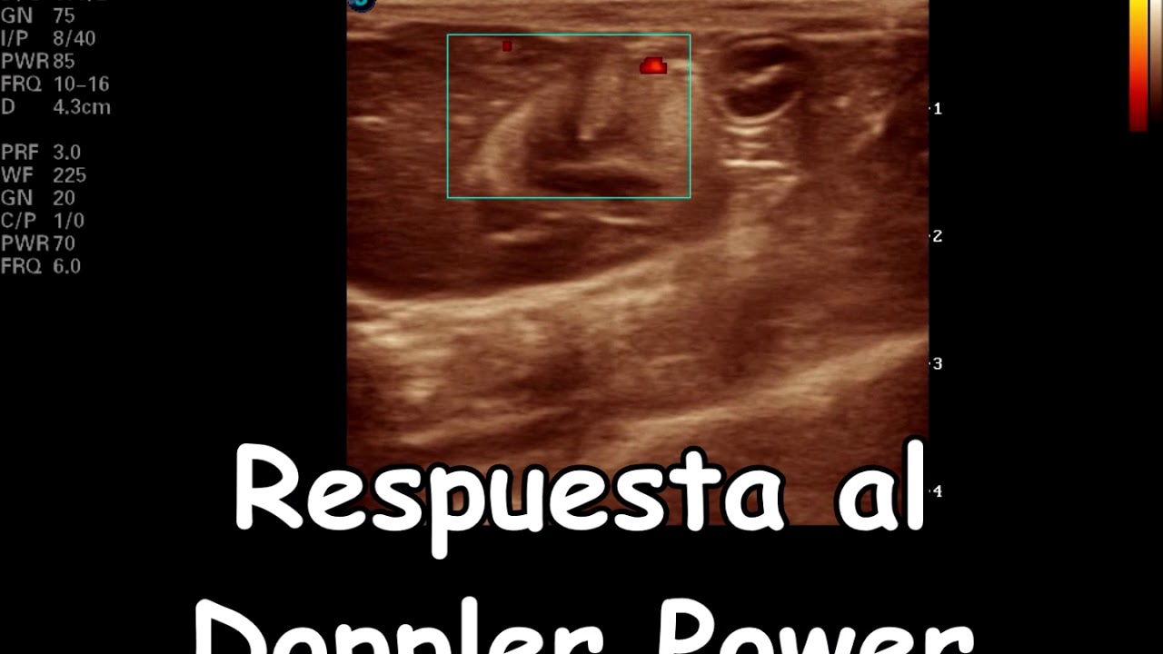 Ecografía de una Masa Renal en un perro macho - YouTube