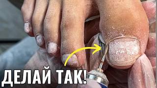 видео: 😭УСТАЛА МУЧАТЬСЯ! У клиентки СНОВА ПОДНОГТЕВЫЕ МОЗОЛИ! ПОДРОБНО про ПЕДИКЮР! картинка: 😭УСТАЛА МУЧАТЬСЯ! У клиентки СНОВА ПОДНОГТЕВЫЕ МОЗОЛИ! ПОДРОБНО про ПЕДИКЮР!