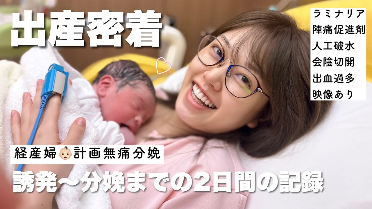 【出産レポ】感動🥹誘発〜分娩まで完全密着2日間🎥‼︎計画無痛分娩/経産婦🤰