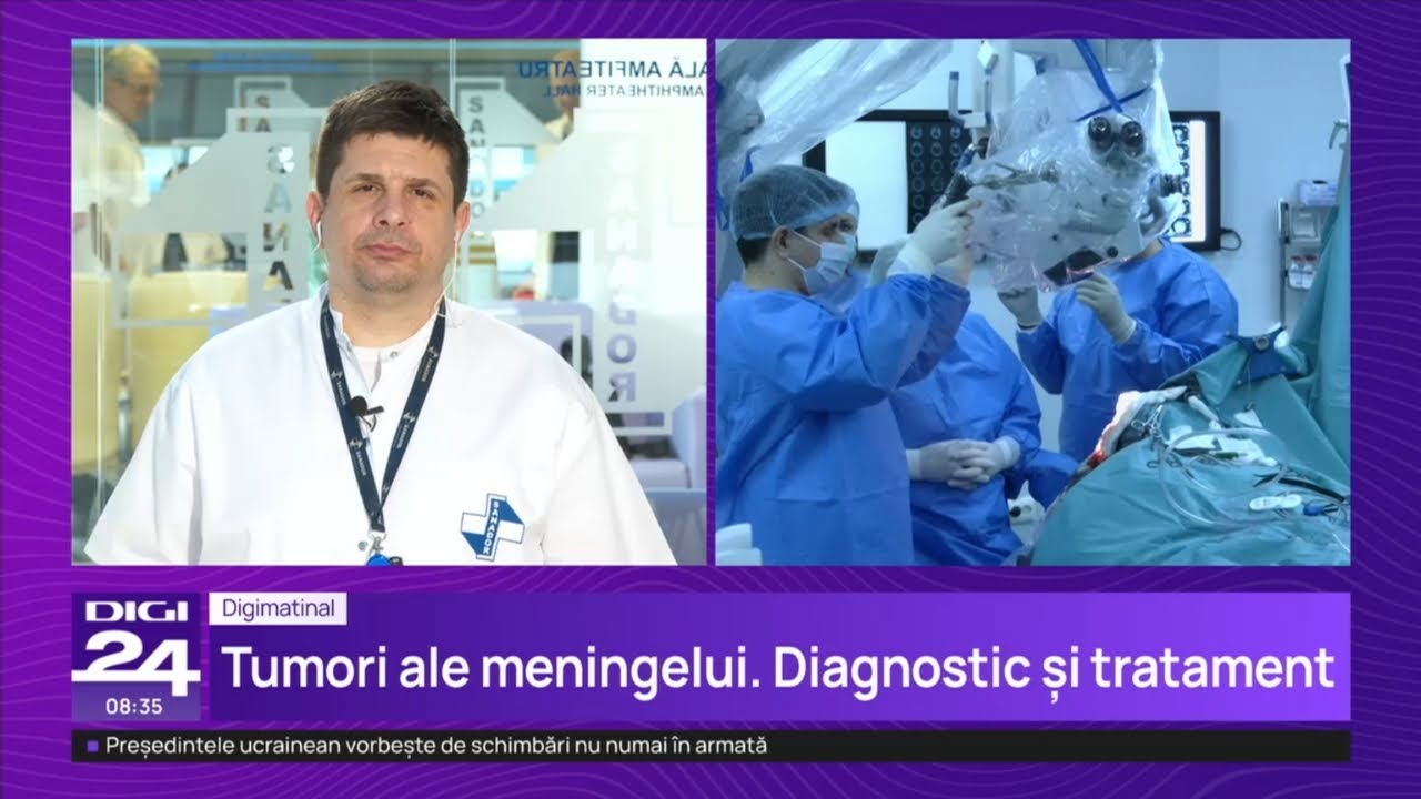 Meningioamele cerebrale – Dr. Dan Benția | Spitalul Clinic SANADOR