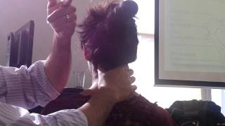 Sharp purser, transverse ligament in supine