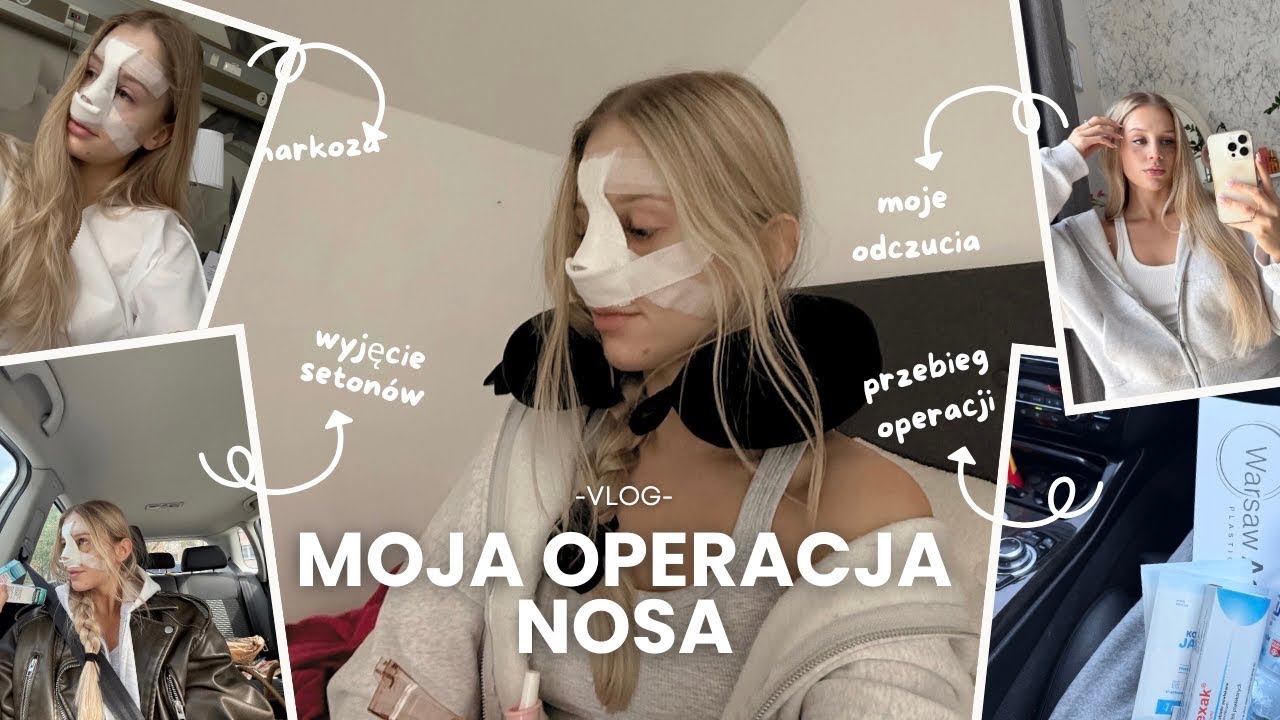 VLOG: MOJA OPERACJA NOSA